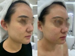 体验后-明潪Selfology升维护理中心