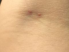 -华中科技大学同济医学院附属同济医院(汉口院区)