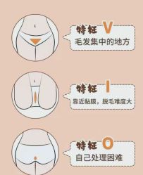 -薇兰专业脱毛连锁机构