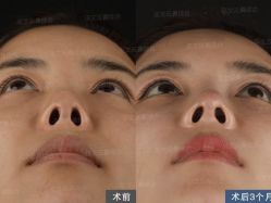 -北京米扬丽格医疗美容·联合丽格鼻整形中心