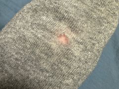 -曹树华专业无痕织补