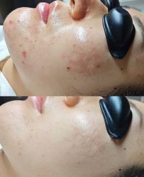 -彼家美创·量肤定制修护管理