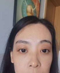 -天津健丽·去眼袋医疗美容机构