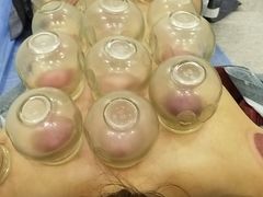 -张钰强中医正骨推拿连锁(唐家人才公寓店)