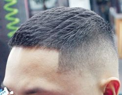 -大麦微针植发丨全国连锁