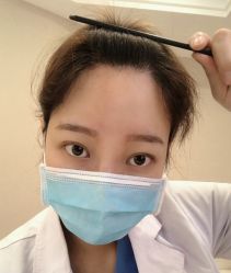 -大麦微针植发全国连锁