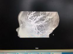 -浙江大学医学院附属儿童医院(湖滨院区)