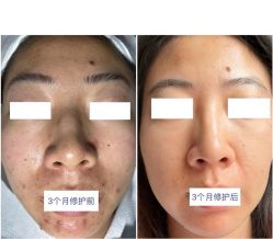 -美肤盾祛痘·问题肌管理中心