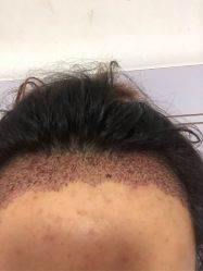 -雍禾植发全国连锁