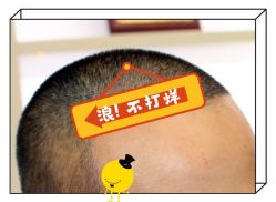 -大麦微针植发全国连锁