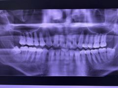 -土豆口腔(凤凰北总店)