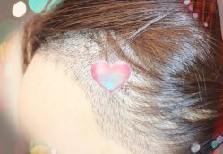 -大麦微针植发全国连锁