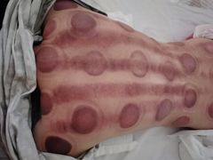 -益友堂盲人推拿正骨穴位按摩工作室