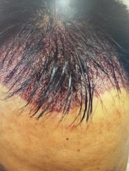 -雍禾植发全国连锁