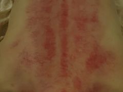 -筋骨堂热敷推拿按摩(招商花园城店)