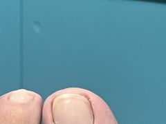-Andrew指甲专科灰指甲·甲沟炎矫正·3D步态矫形鞋垫定制(浦三路店)