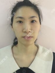 体验前-广州美莱医疗美容医院