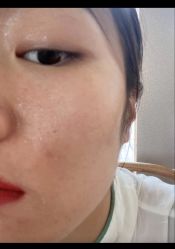 -成都西区医院整形美容