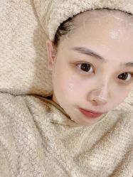 体验后-柠檬一美·Ondapro·轻薄紧致抗衰中心