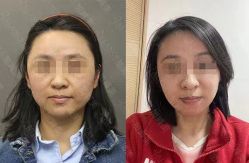 -加减美医美连锁品牌