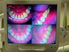 -土豆口腔(凤凰北总店)