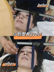 -颜和骨正·明哲式骨相美学整骨