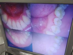 -土豆口腔(凤凰北总店)