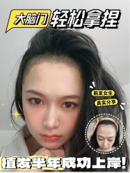 -雍禾植发