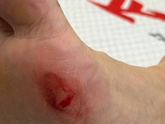 -郑远元专业修脚房(国顺东路店)