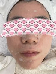 体验后-金圣医疗美容