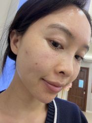 -长沙雅美医疗美容医院