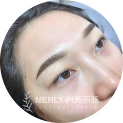 -MLP美丽派·问题肌疗愈中心
