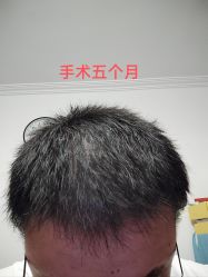 -北京雍禾植发医院