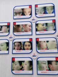 -悟空祛痘·诺奖技术专业店