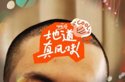 -大麦微针植发全国连锁