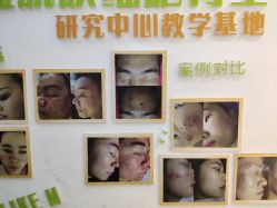 -莱可美科技美肤