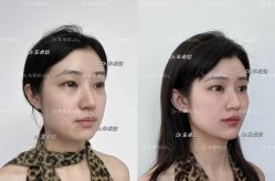 -Yestar重庆艺星医疗美容医院