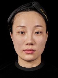 体验后-南宁华美医疗美容医院