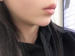 -杭州星婉馨悦医疗美容
