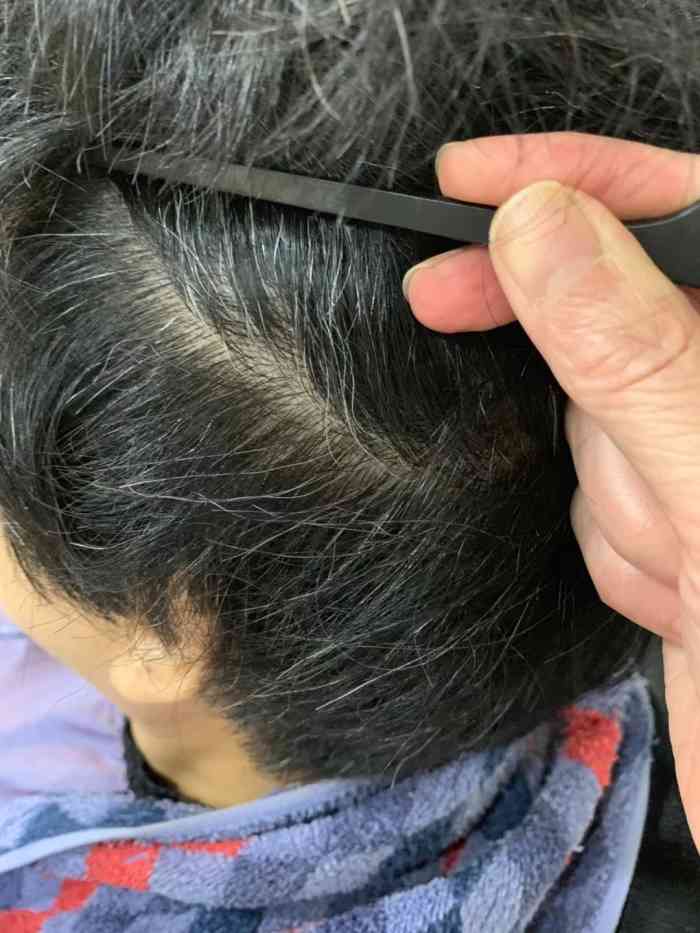 黑茸老姜王脱发生发 白发转黑-"我是在大众点评看到了这家店,我也是