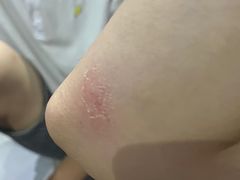 -嘿哟动霸CHUA·新潮玩运动娱乐中心·蹦床滑冰团建乐园