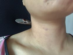 -郡艺医疗美容·微整·眼鼻吸脂