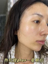 -西安壹加壹医疗美容·西北抗衰旗舰店