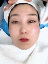 -亿美医疗美容·半岛大超炮官方授权店