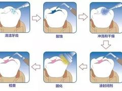 -团圆口腔·种植中心(锦江院区)