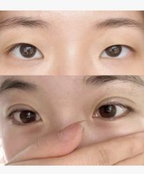 -上海伊莱美医疗美容医院