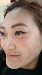 -爱莎扁平疣·汗管瘤·斑痣中心