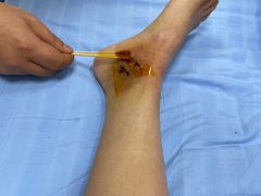 -成都市第一人民医院(南区)