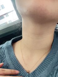 体验前-颜蕾医美黄金微针水光美肤玻尿酸抗衰中心