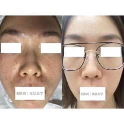 -美肤盾祛痘·问题肌头疗管理中心